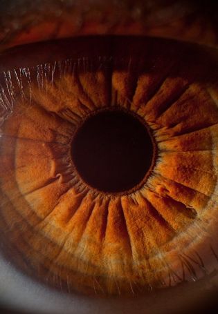 Карий зрачок