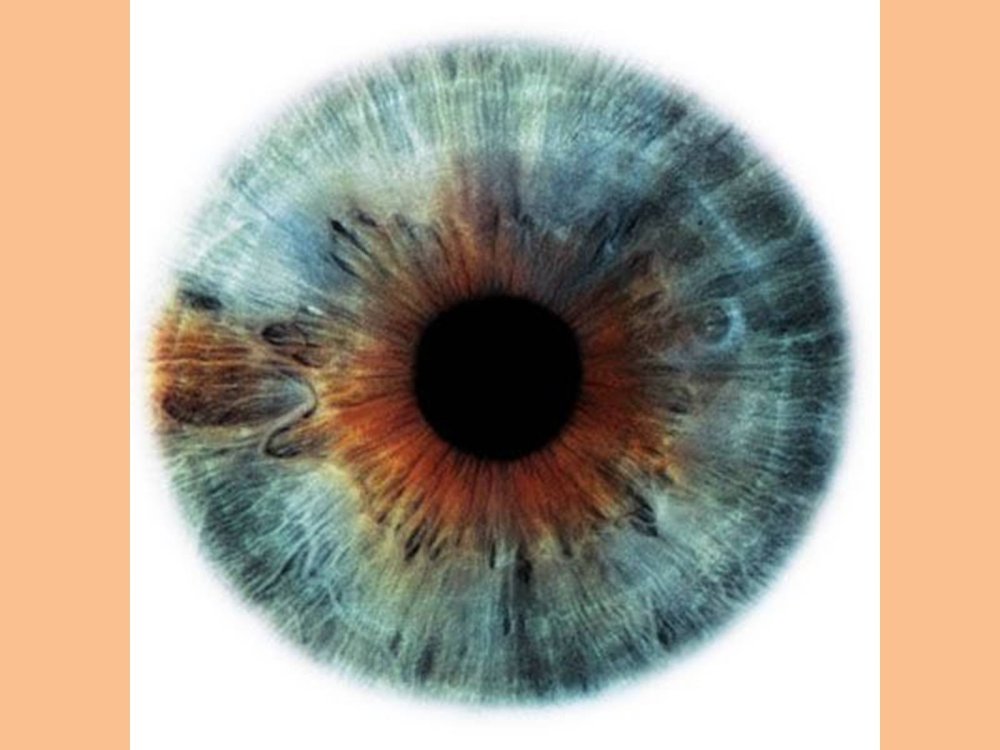 Радужка глаза