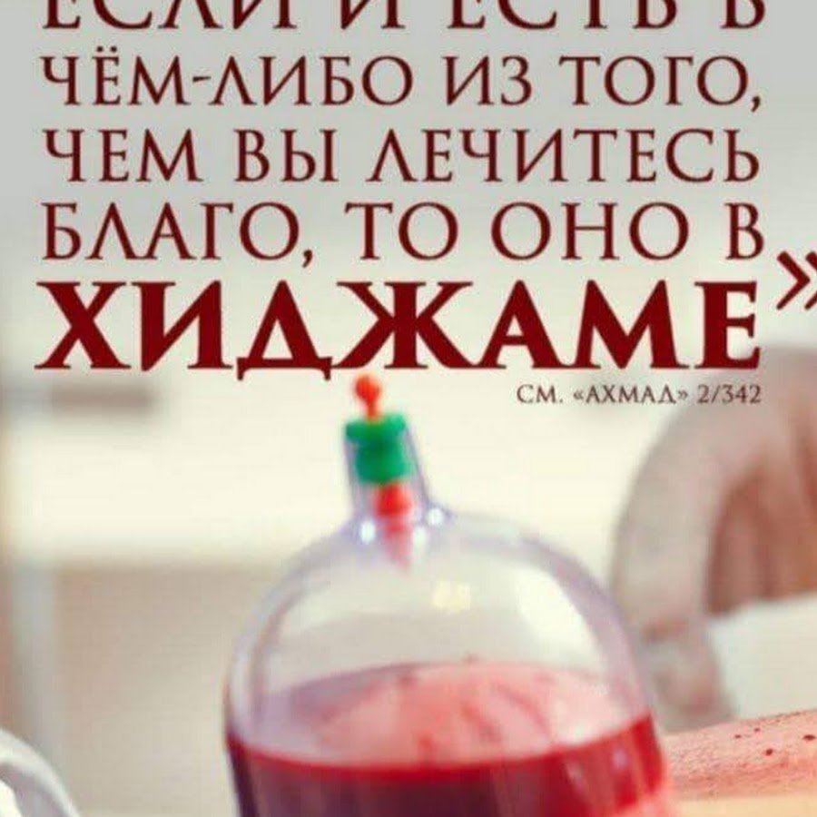 Инструменты для хиджамы