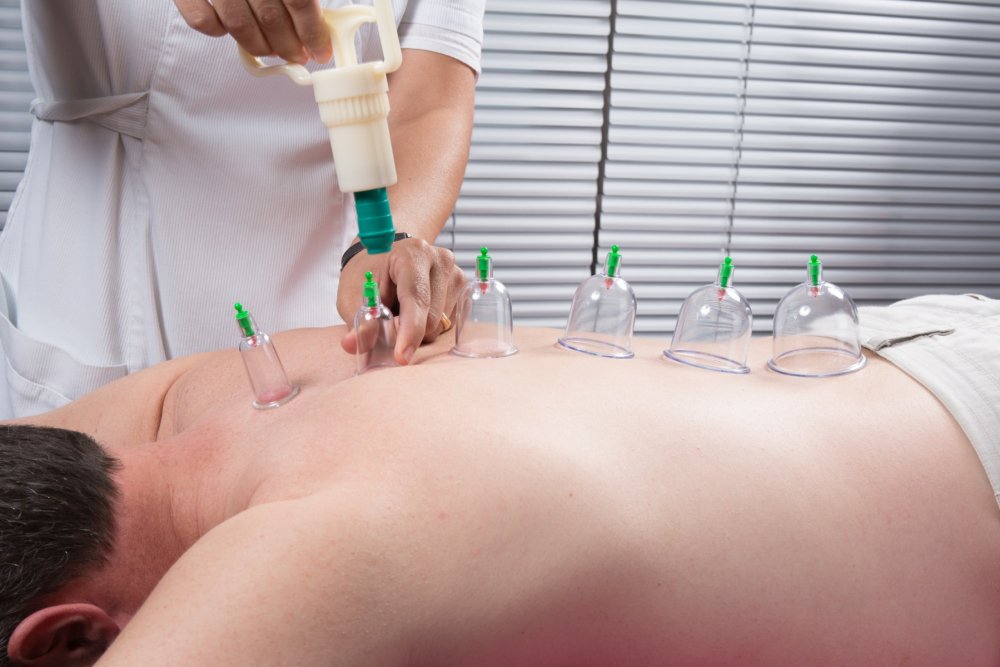 Массаж хиджама кровопускание вакуумный