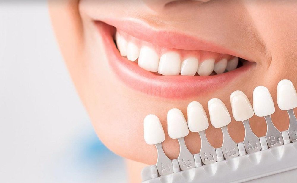 Красивые ровные зубы