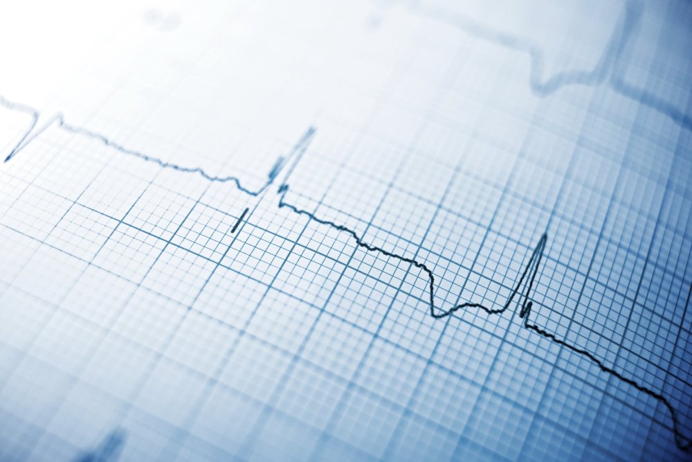 ЭКГ на синем фоне