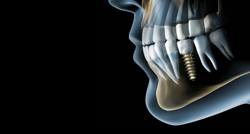 Черный фон на аву