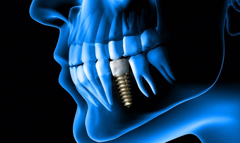 Страшная улыбка без фона