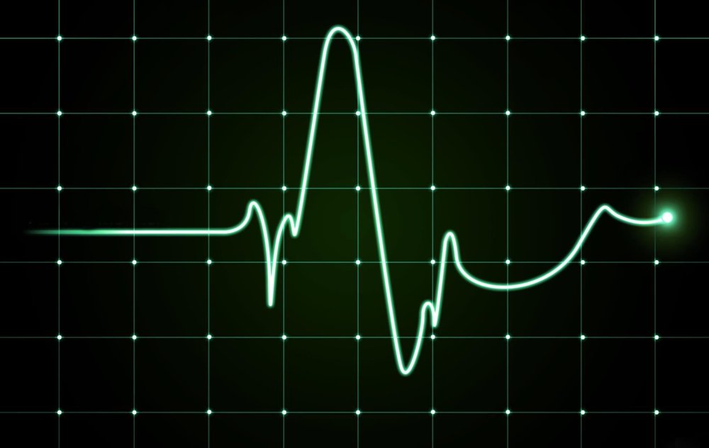 Сердцебиение на черном фоне