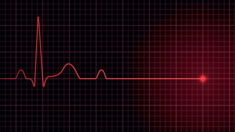 Импульс картинки