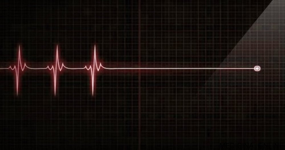 Зелёный пульс на чёрном фоне