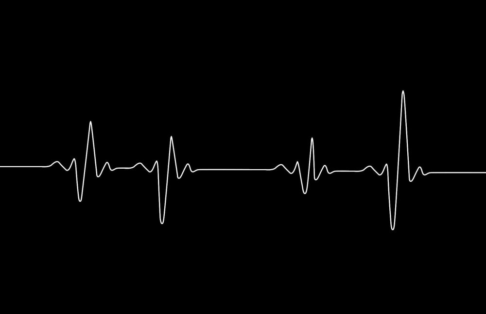 Диаграмма биения сердца