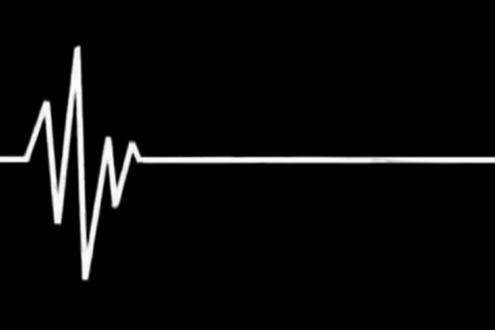 Кардиограмма смерти