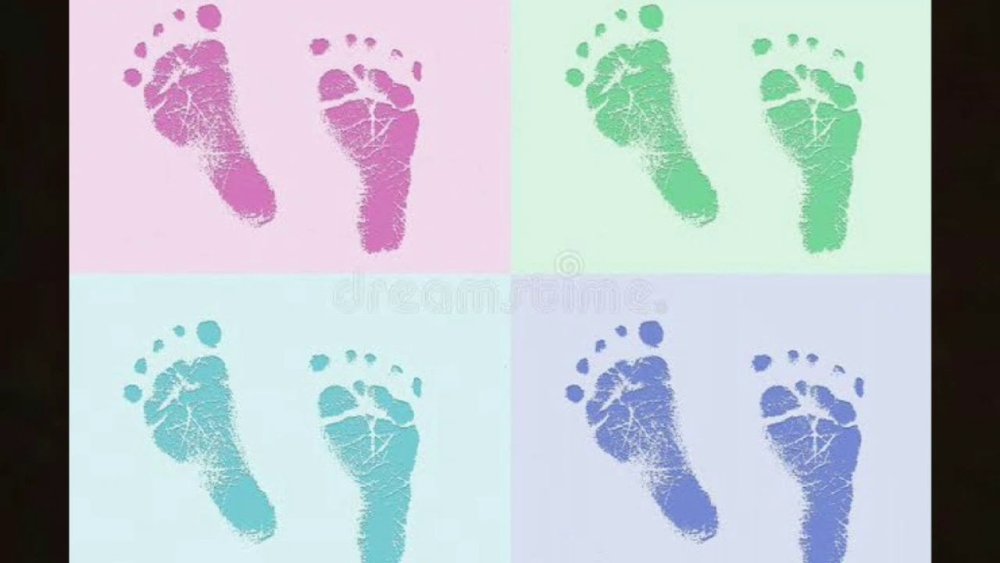 Отпечаток ноги с плоскостопием