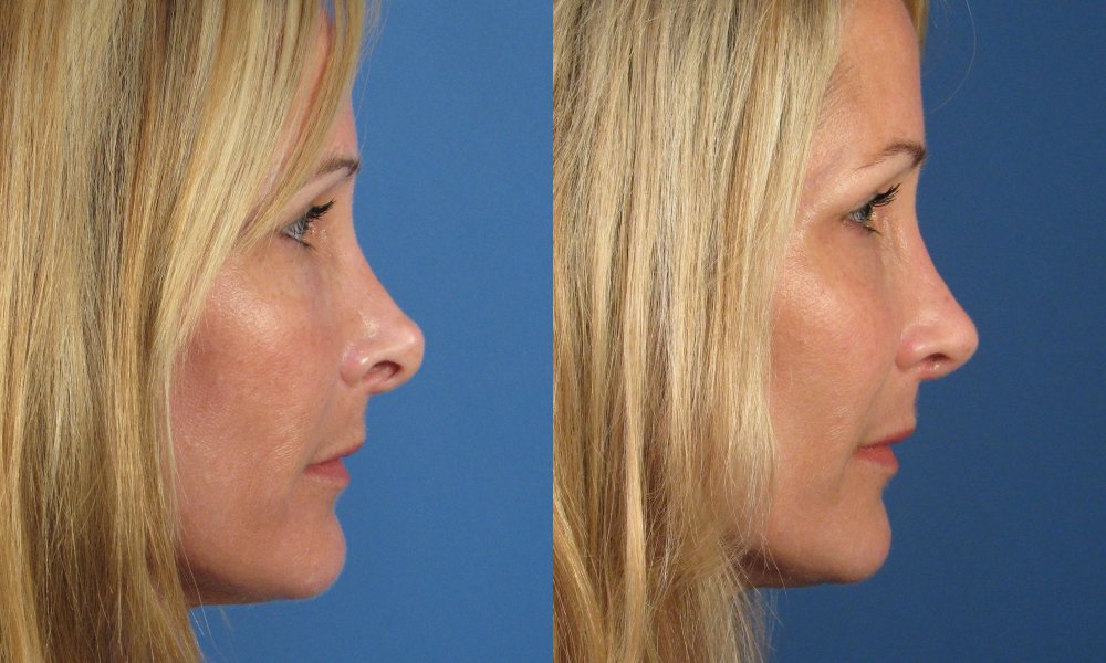 Анджелина Джоли профиль