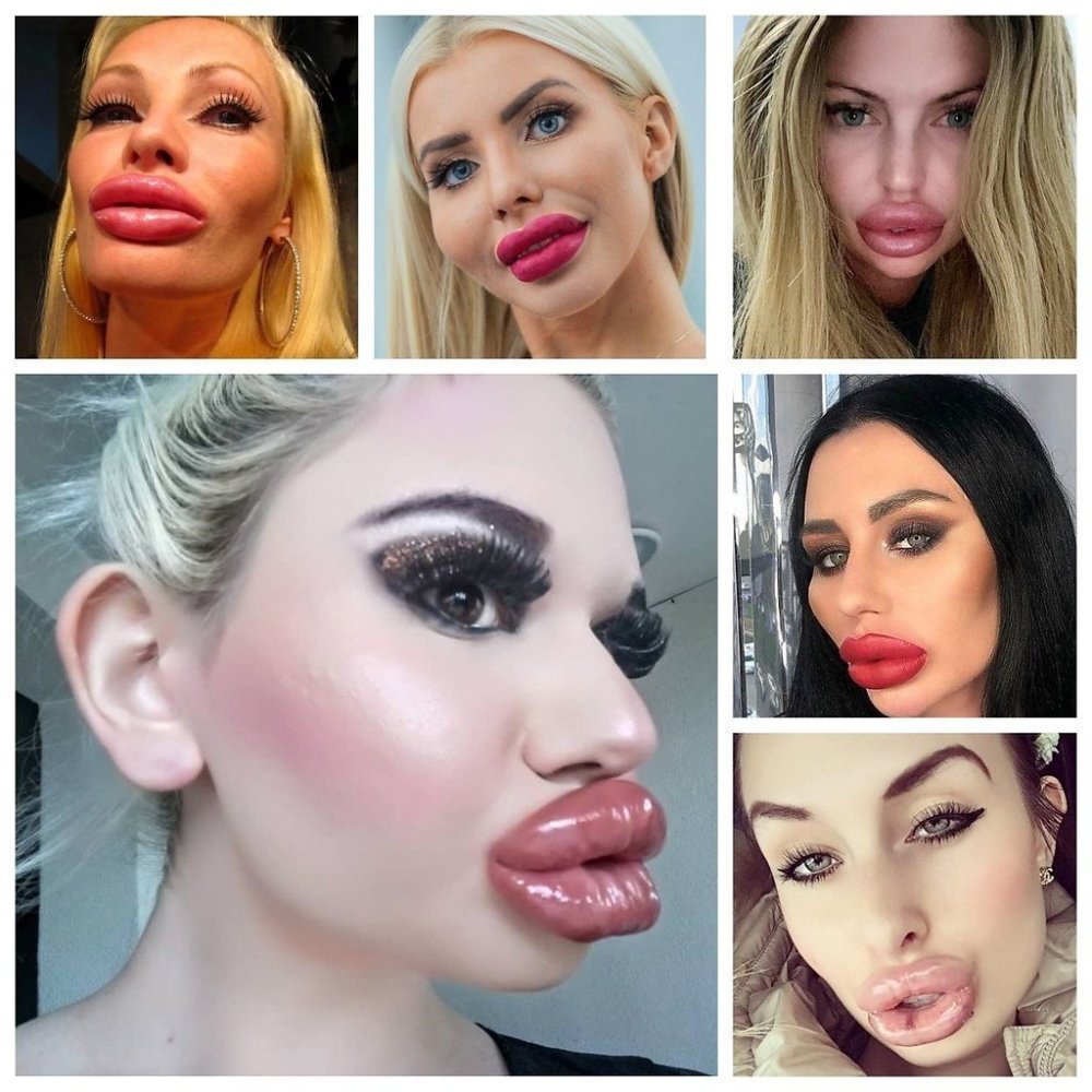 Большие губы у известных блоггеров