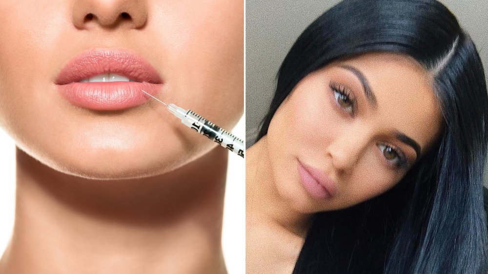 Увеличенные губы красивые