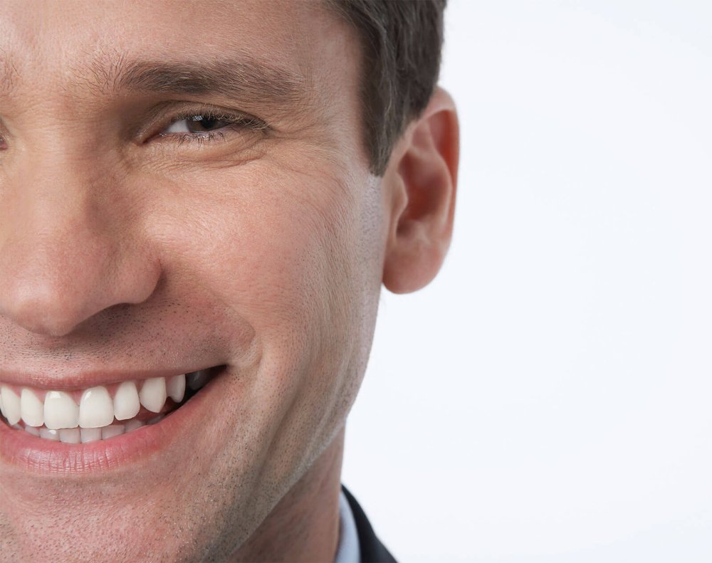 Красивый мужчина в Инвизилайн