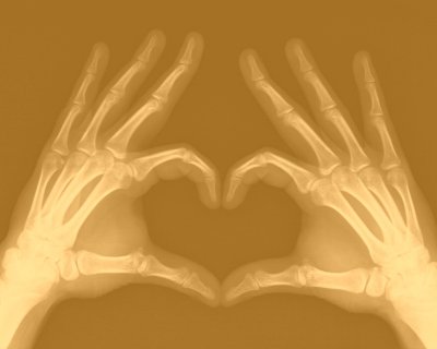 Рентген ладони