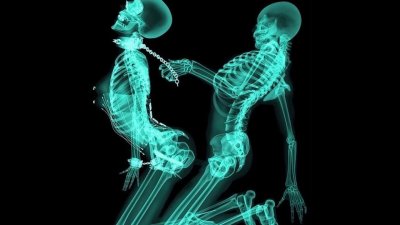 Рентген человека