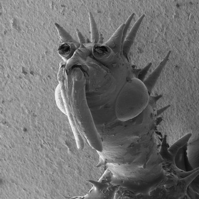 Микроомы под микроскопом