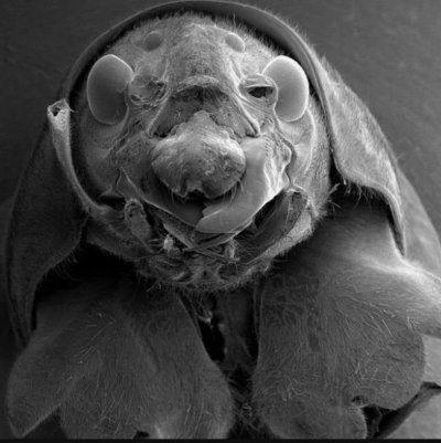 Самые страшные микробы под микроскопом