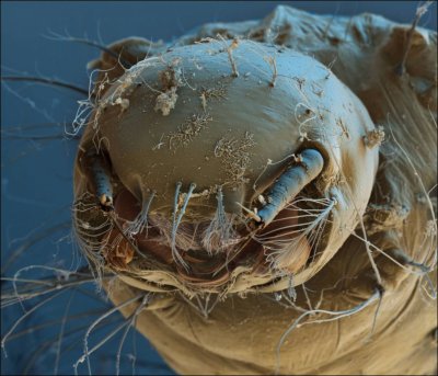 Бактерии под ногтями под микроскопом