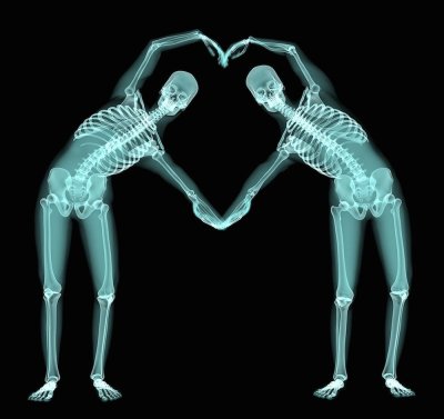 Рентген человека